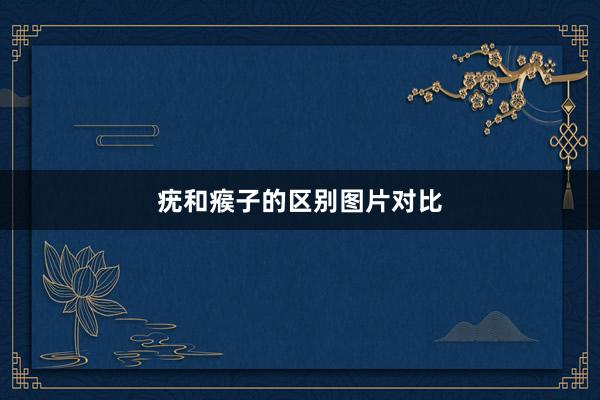 疣和瘊子的区别图片对比
